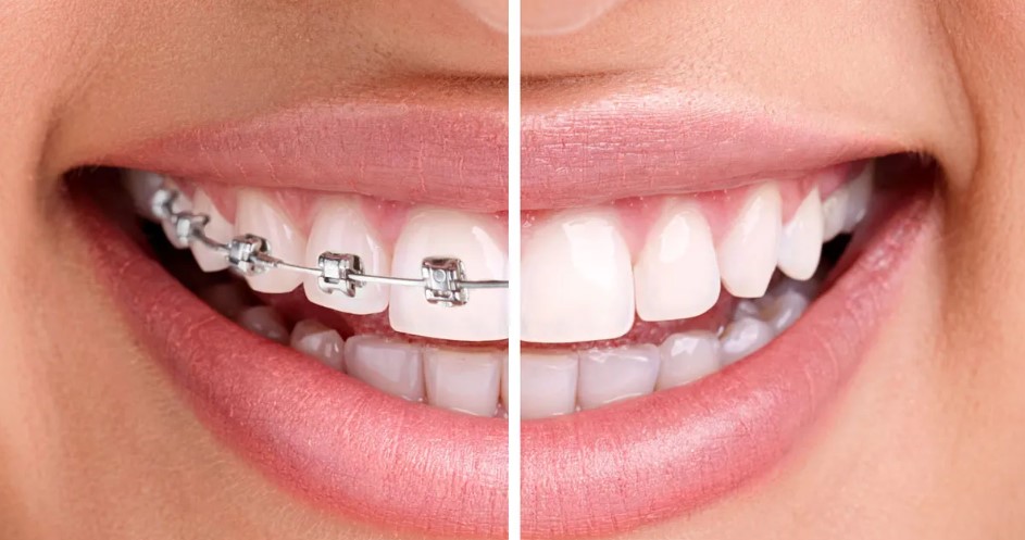 Cristaldent: il tuo studio dentistico di fiducia a Torino Cristaldent: il tuo studio dentistico di fiducia a Torino