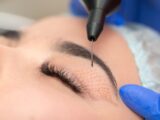 Blefaroplastica non chirurgica a presso la clinica torinese Cristalbeauty